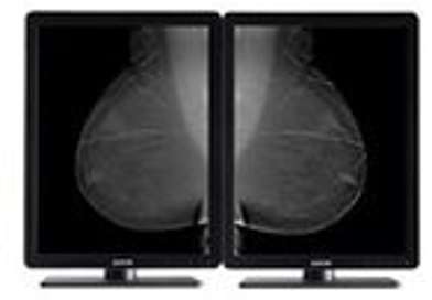 Barco Nio 5MP MDNG-5221 - écran LED - 2 x 5MP - ni