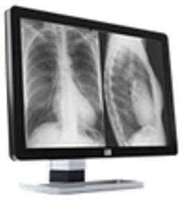 Barco Coronis Fusion 10MP MDCG-10130 - écran LCD -